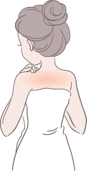 Folliculitis on Skin vector