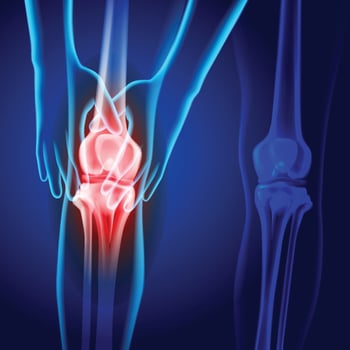X-ray image of two hands holding knee showing knee joint injury on dark blue background. vector