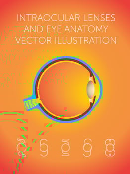 intraocular lenses and eye anatomy vector illustration
