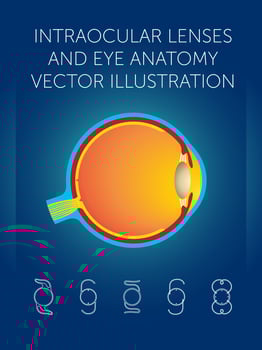 intraocular lenses and eye anatomy vector illustration