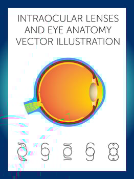 intraocular lenses and eye anatomy vector illustration