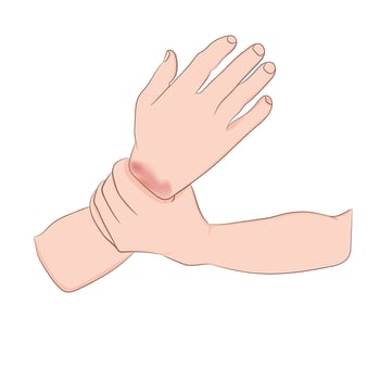 image graphics vector outline Wrist pain is often caused by sprains or fractures from sudden injuries concept health care