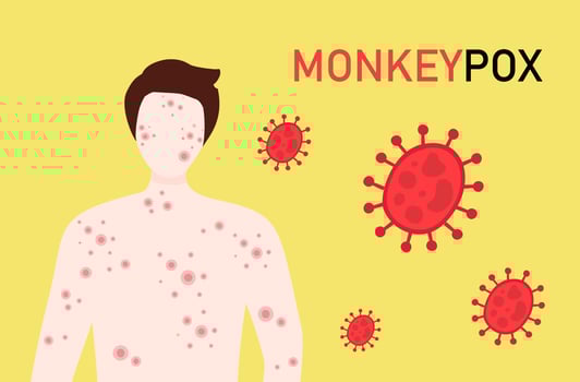 Monkeypox virus concept, woman suffering with rash on all body. New orthopox virus outbreak pandemic spreading vector illustration
