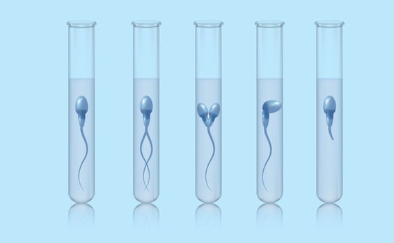 Morphology, spermatozoa in a medical test tube. A set of test tubes with spermatozoa. Sperm motility analysis. Medical poster. Vector illustration