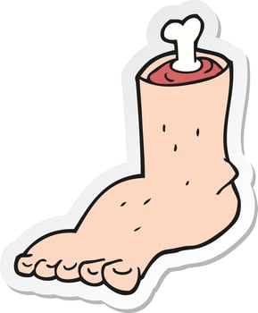 sticker of a cartoon severed foot vector