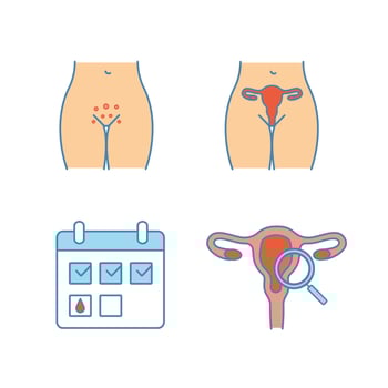 Gynecology color icons set. Genital rash, female reproductive system, menstrual calendar, gynecological exam. Isolated vector illustrations