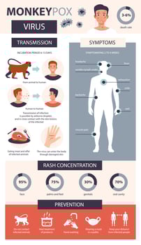 Monkey pox infographic. Infection, symptoms, prevention of the disease of monkey pox. Flat vector illustration.