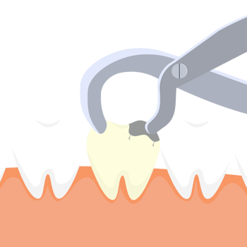 Dentist pulling out a dead tooth with equipment. Dental care activities with a dentist nipper and a dead tooth vector. Dead tooth extraction Illustration. Teeth removal concept. png
