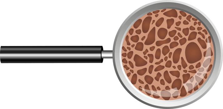 Osteoporosis bone clipart design illustration png