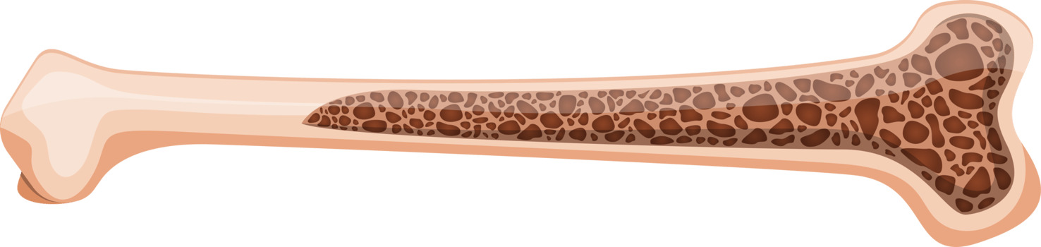 Osteoporosis bone clipart design illustration png