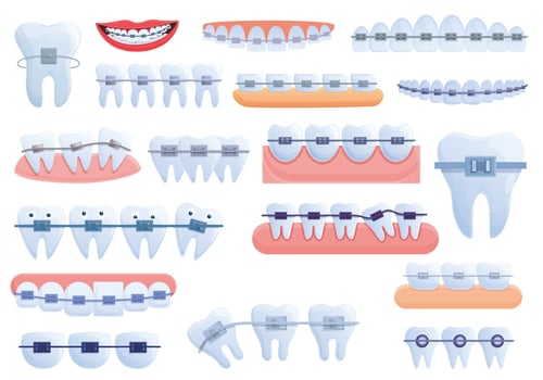 Tooth braces icons set, cartoon style vector
