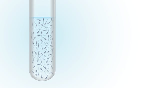 Test tube with spermatozoa. Scientific illustration with semen, spermogram and reproductive health concept. Blue gradient background. copy space. vector