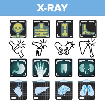 X-ray Icon Set Vector. Radiology Scan. Broken Human Bone. Medical Symbol. Fracture Structure. Health Hospital Medicine Design. Line, Flat Illustration vector