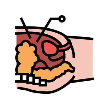 operation process bariatric color icon vector illustration