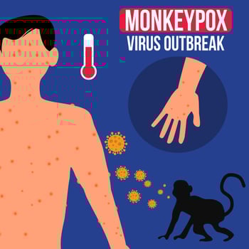 monkeypox virus outbreak illustration suitable for poster and infographic vector