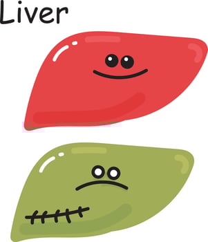 stock illustration vector drawing. internal organ liver comparison healthy and diseased organ. doodle cartoon style isolated on white background for children medical theme