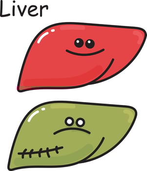 stock illustration vector drawing. internal organ liver comparison healthy and diseased organ. doodle cartoon style isolated on white background for children medical theme