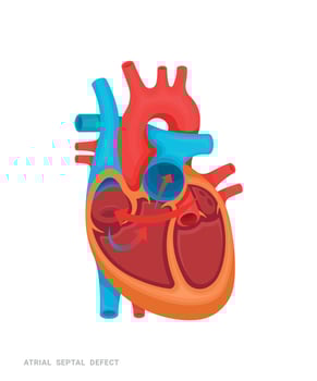 Heart of Defect vector