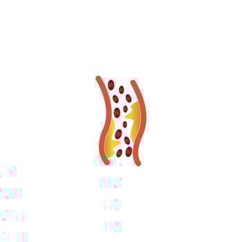 cholesterol plaque icon vector
