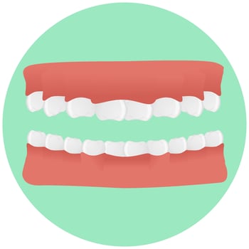 Jaw. Teeth Set in realistic style. Colorful vector illustration isolated on background.