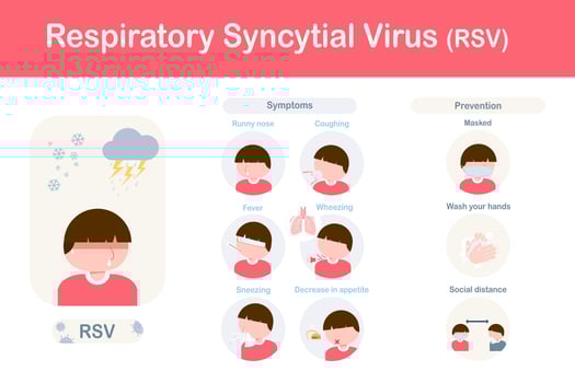 Respiratory syncytial virus symptoms.flat design vector