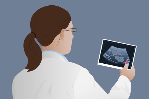 Pregnant woman with twins in the womb. Vector illustration