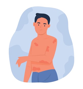 Man with Atopic Dermatitis or Eczema on Body vector