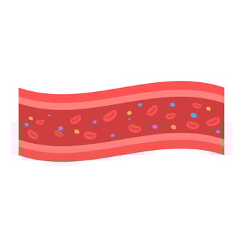 coronary arteries with accumulated fat in the body vector