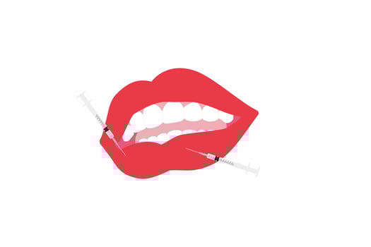Lips filler injections. Sensual lips and syringes. vector