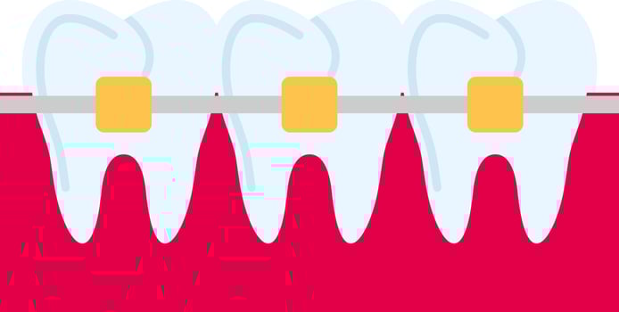 Braces Vector Icon Design
