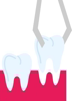 Teeth Extraction Vector Icon Design