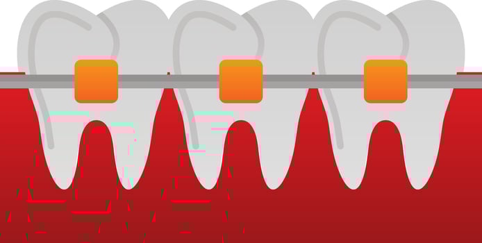 Braces Vector Icon Design