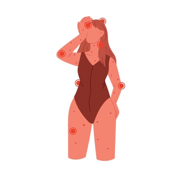 Disease symptoms. Woman with headache, rash, fever. Flat vector illustration