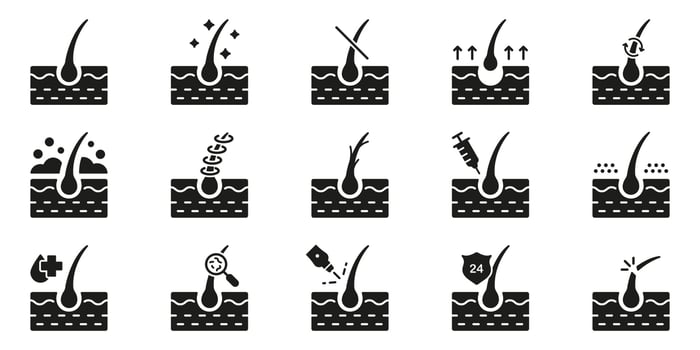 Hair Loss, Growth, Transplant, Removal, Care Silhouette Black Icon Set. Healthy Dermatology Therapy for Epidermis Glyph Pictogram. Hair Follicle Treatment Icon. Isolated Vector Illustration.
