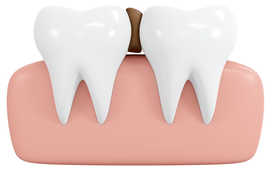 3D Rendering teeth with food stuck in between icon cartoon style. 3D Render illustration. png
