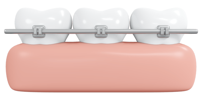 3D Rendering teeth braces icon cartoon style. 3D Render illustration. png