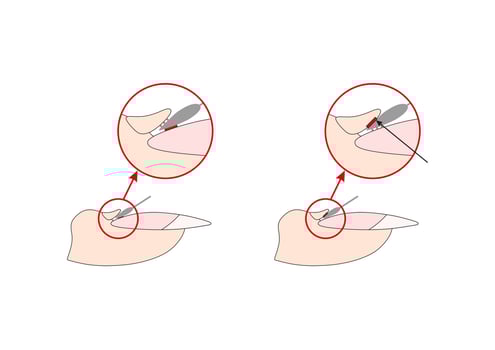 Nails cuticle instruction guide. Cutter manicure instrument. Tutorial. vector