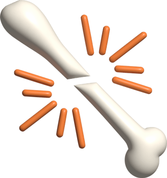 3d illustration of broken bone png