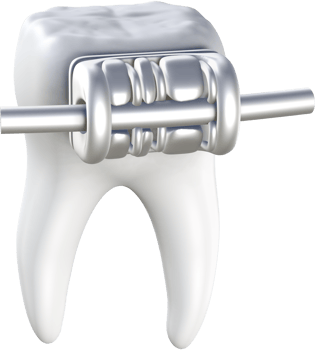 Dental braces 3D icon. png