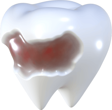Teeth decay 3D icon illustration. png