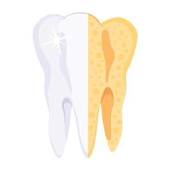 Trendy Tooth Cavity vector