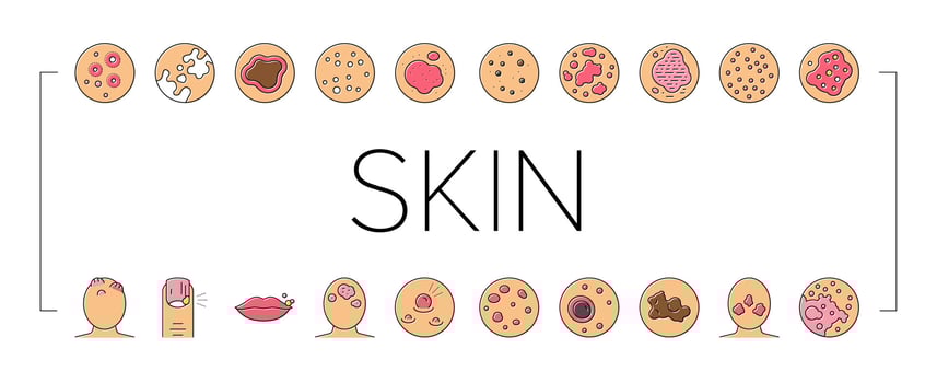 Skin Disease Symptom Collection Icons Set Vector