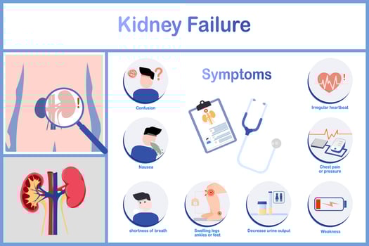vector illustration.Symptoms of kidney failure incluing nausea and vomitting Irregular heartbeat,decreased urination,chest pain and pressure.including edema.flat stye.healthcare and medical concept.