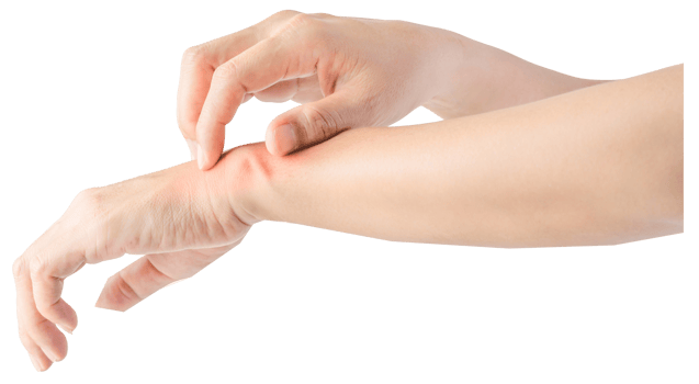 Woman scratching arms because of the itching. png