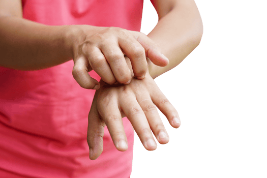 Asian woman having an itchy arm png
