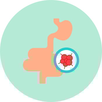 Intestines Cancer Vector Icon