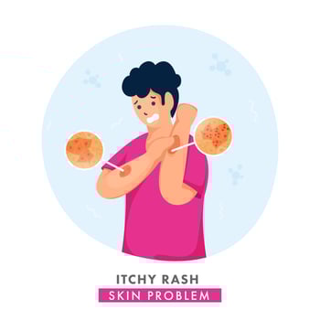 Cartoon Young Boy Itching His Hands And Showing Skin Rashes on White Background. vector