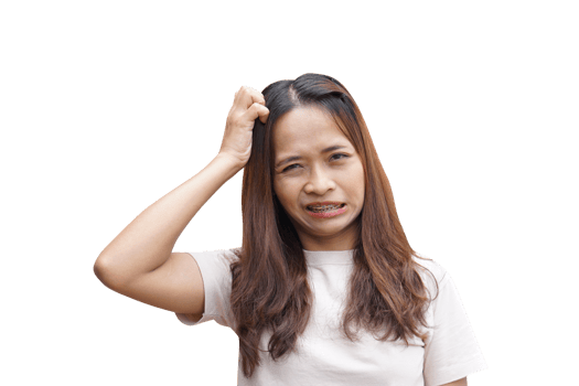 Asian woman having itchy head from dandruff png