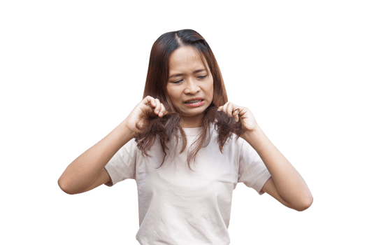 Asian woman having itchy head from dandruff png