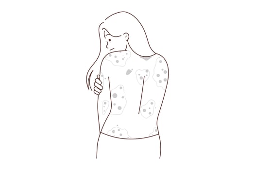 Unhealthy woman showing red rash on back suffer from dermatitis. Unwell girl struggle with dermatology disease. Healthcare concept. Vector illustration.
